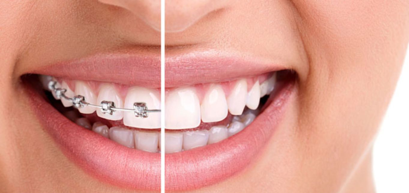 best dentist in pitampura